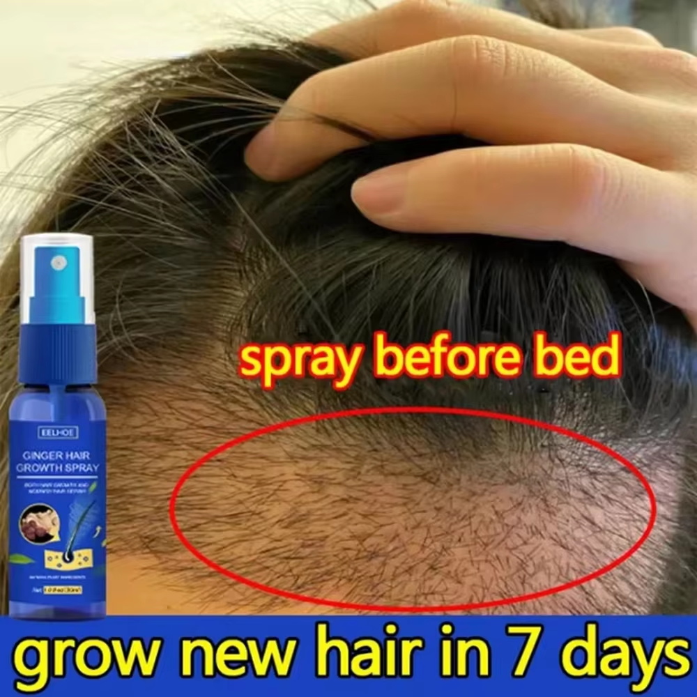 Hair Care Products - Ginger Hair Growth spray Anti Hair