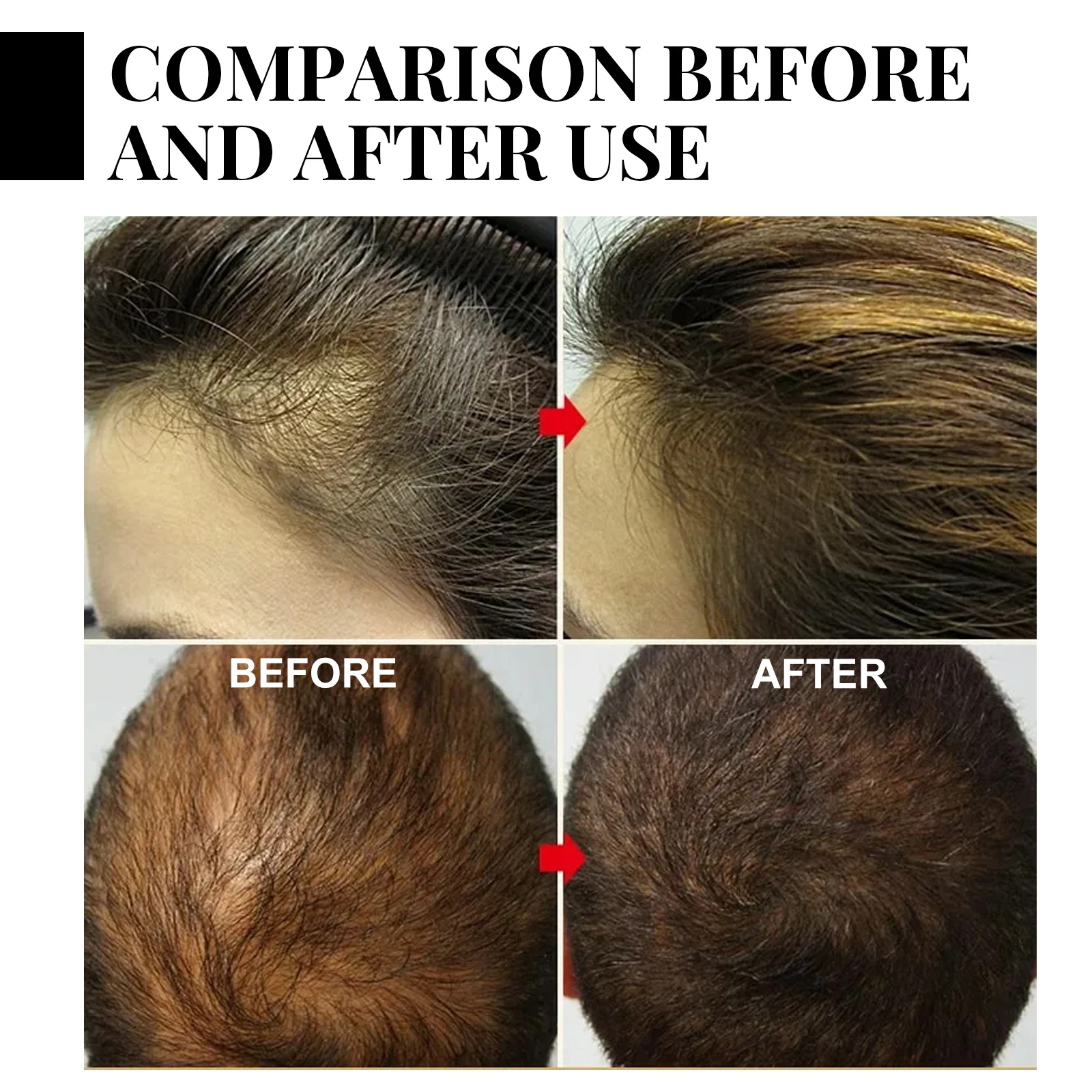 Ginger Hair Growth spray Anti  - Hair Care Products incelemesi ve fiyatı