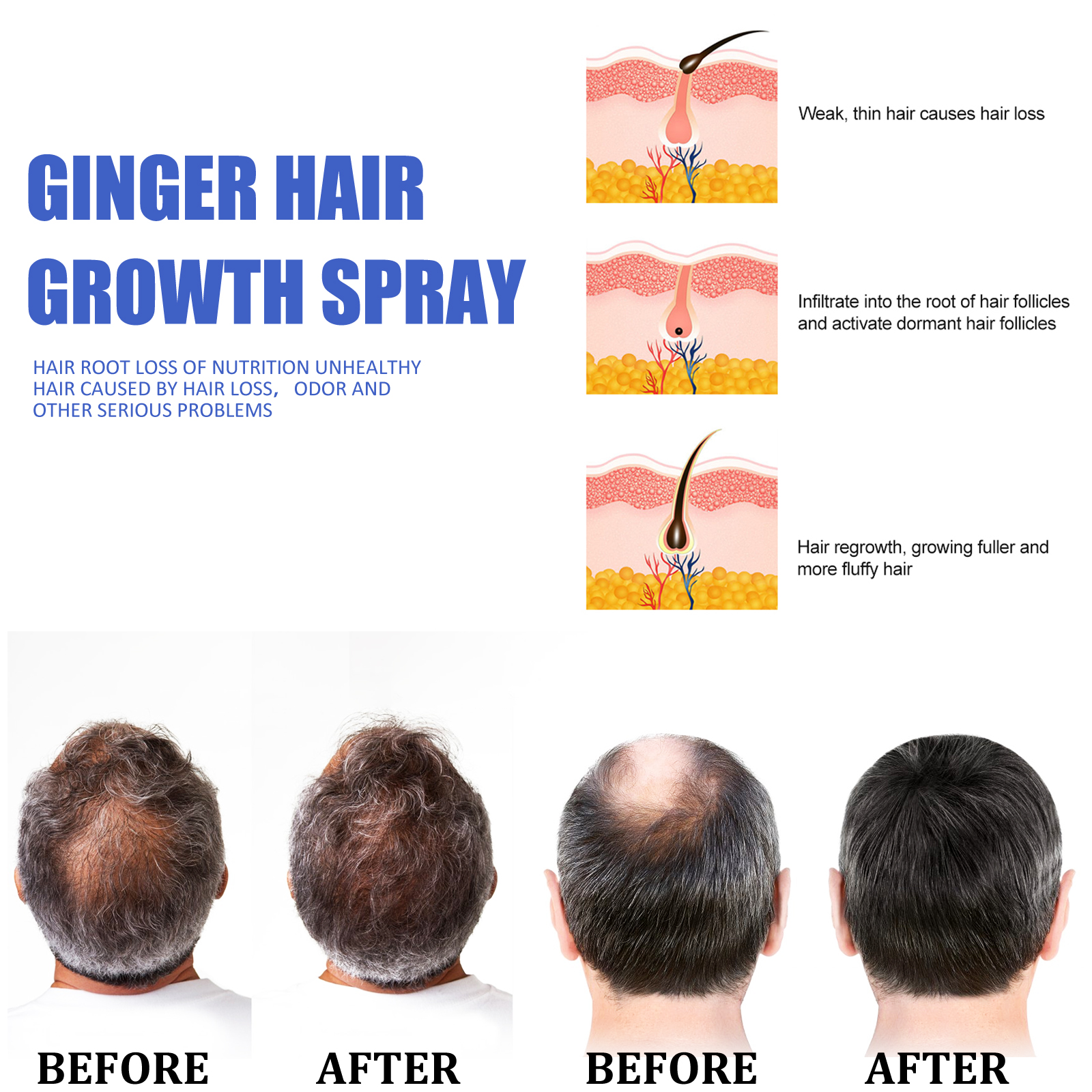 Ginger Hair Growth spray Anti  - Hair Care Products incelemesi ve fiyatı