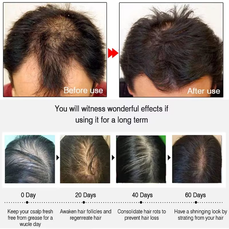 Ginger Hair Growth spray Anti  - Hair Care Products incelemesi ve fiyatı